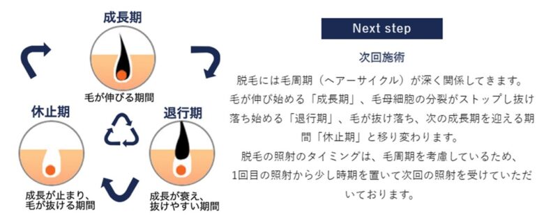 毛周期（ヘアーサイクル）は人によって違う